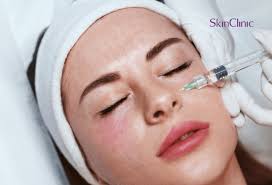 Vẻ ngoài rạng rỡ cùng phương pháp tiêm meso trị sẹo rỗ