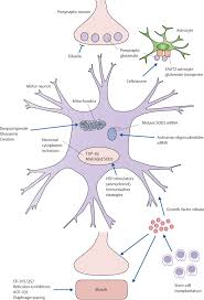 Amyotrophic lateral sclerosis is a neurodegenerative neuromuscular disease that results in the progressive loss of motor neurons that control voluntary muscles. References In Emerging Targets And Treatments In Amyotrophic Lateral Sclerosis The Lancet Neurology