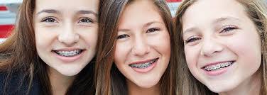 Advantages Of Visiting A Dental Clinic In Singapore Types Of Braces Braces Dental Implant Procedure