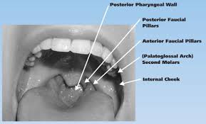 Image result for Gag Reflex