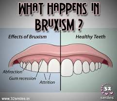 Seen So Often Treated In One Day By Computerised Dentistry Dentistry Dental Hygiene School Dental