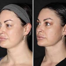 SILICON VALLEY INSTITUTES FOR AESTHETICS