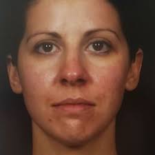 REBECCA FITZGERALD, MD