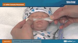 Pediatric nasal cannula for babies / infants with 7 foot tubing. Oxygen Humidified High Flow Oxygen Or Air For Neonates