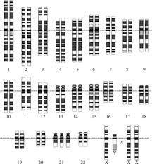 aneuploidy wikipedia