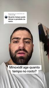Quanto Tempo Deoois De Usar Minoxidil Surgem Resultado