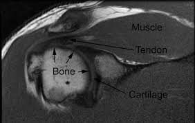 The intrinsic foot muscles comprise four layers of small muscles that have both their origin and insertion attachments within the foot foot muscles mri. Mri Scan London Sports Orthopaedics