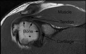 The second part is on the plantar group of muscles. Mri Scan London Sports Orthopaedics