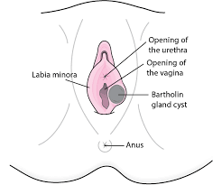 Bartholin Gland Cysts - Women's Health Issues - Merck Manuals Consumer  Version
