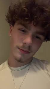 Scars #fypp #fy #scar #good #vulture