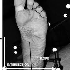 Paula farsi in high heels : Midswing Average Emg Activity Oithe Anterior Tibialis An Download Scientific Diagram