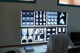 Docteur henry xavier est aussi disponible à d'autres adresses. Blain Le Cabinet De Radiologie Va Rouvrir Ses Portes Ce Lundi 31 Aout L Eclaireur De Chateaubriant