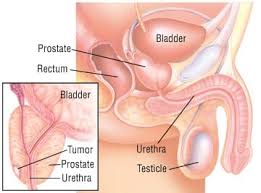 Image result for Prostate Specific Antigen
