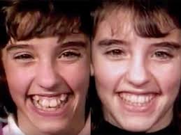 More often than not, people have teeth that's a little crooked or perhaps misaligned. Time Lapse Shows How Braces Work