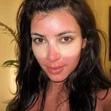 How can i stop my sunburn from peeling so much? How To Get Rid Of Sunburn Fast Reduce Redness Prevent Peeling Glamour