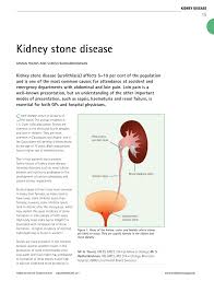 Pdf Kidney Stone Disease
