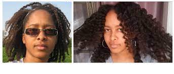 Msm Hair Growth Results Before And After Pictures Msm Hair Growth Miracle Hair Growth Hair Growth Methods