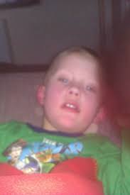 The Ehlers-Danlos Society