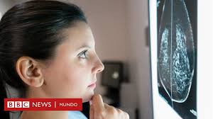 We did not find results for: El Modelo Que Permite Predecir Que Riesgo De Recaida Tiene Un Cancer De Mama Bbc News Mundo