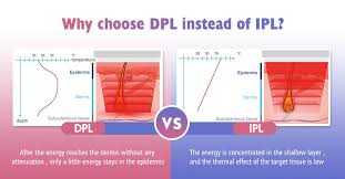 59667 likes · 160 talking about this · 8 were here. Ipl Laser Hair Removal Equipment Factory Supply Aesthetics Skin Rejuvenation 1064 808 755nm China Ipl Hair Removal Device Ipl Made In China Com