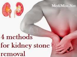 4 Methods For Kidney Stone Removal Kidney Stones How To Remove Folk Remedy