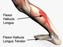 Tibialis posterior, flexor digitorum and flexor hallucis longus tendons: Flexor Hallucis Longus Tendonitis Physioadvisor