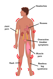 Image result for Connective Tissue Disorder
