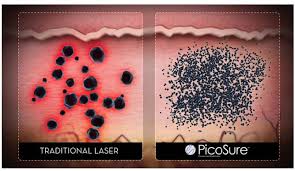 She completed her residency in dermatology at marshfield clinic/st. Laser Tattoo Removal Sawka Md