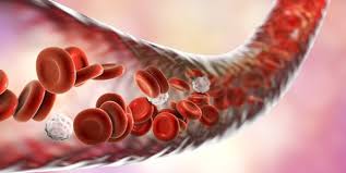 Damar Tikanikligi Nedir Damar Tikanikligi Belirtileri Nelerdir Damar Tikanikligi Nasil Tedavi Edilir