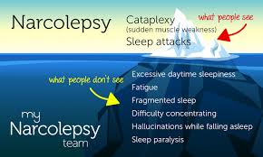 Image result for Narcolepsy