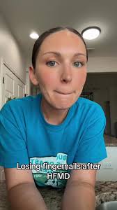 Has this ever happened to yalls kids? 😫 #hfmd #losingfingernail #nails  #hfm #kids #momlife