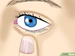 If it feels like the lens is stuck under your upper eyelid, for example, then look down. How To Take Out Contact Lenses Without Touching Your Eye 12 Steps