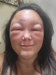 Can a honey bee queen be accepted by another type?