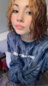 Teenager with an ultra-rare allergy to water feels like she is being 'set 