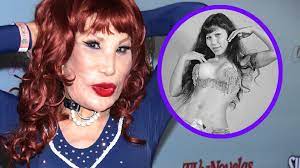 Lyn may en noches de cabaret (1978). Lyn May Antes Y Despues De Presumir Su Nuevo Rostro