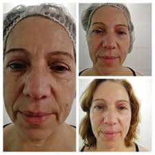 Melhor Serum de Vitamina C para o Rosto de Portugal