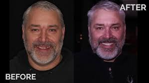 Steve Daggett's CHROME Story