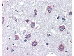 Orphazyme a/s company announcement no. Anti Npc1 Antikorper Produkt Nr Abin462125