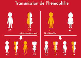 Haemophilia (also spelled hemophilia) is a mostly inherited genetic disorder that impairs the body's ability to make blood clots, a process needed to stop bleeding. L Hemophilie Une Maladie Rare Hereditaire
