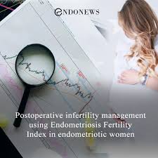 Diagnosis & management of endometriosis: Postoperative Infertility Management Using Endometriosis Fertility Index In Endometriotic Women Endonews