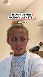 $5000 Surgery Fixed My Lazy Eye 😱