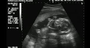 A Las Cuantas Semanas Puedes Sentir Que Se Mueve El Bb Embarazadas Primerizas Babycenter