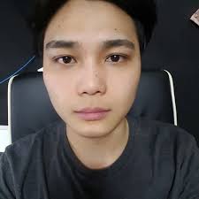 Jaw Reduction and Genioplasty Made my Face Look More Aristocratic