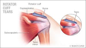 Image result for Rotator Cuff Injury