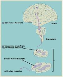 spastic paraplegia foundation pls hsp pls