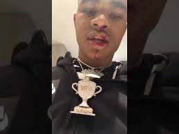 Ybn almight jay was brutally attacked in the financial district area of manhattan and now his attackers will have to answer to j prince. Ybn Almighty Jay Got Shot In His Face Pray For Ybn Youtube