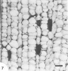 Image result for Allocassine laurifolia