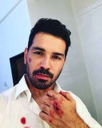 Abhinav shukla is one of the most loved and respected actors in the television industry. Abhinav Shukla En Twitter Action Sfx Make Up For An Action Scene I Always Do Action Makeup By Myself I Used A Tissue Paper To Make Body Of The Cut