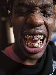 Travis Scott Grillz: Everything you need to know about his new Teeth