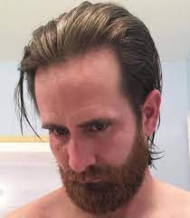 40 Best Haircuts For A Receding Hairline Mens Hairstyles Medium Mens Medium Length Hairstyles Receding Hair Styles